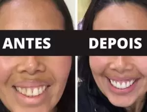 ANTES-e1652726512337-300x229